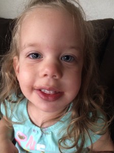 After her Frenectomy and popsicle treat.