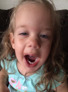 After her Frenectomy and popsicle treat.